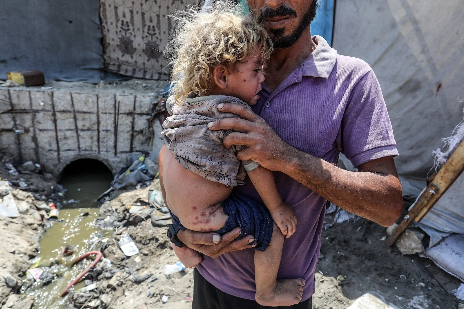 A father holding his injured child in Gaza